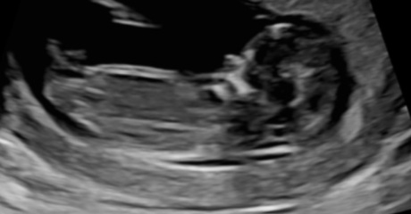 Gender guess please
