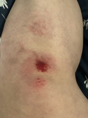 Making a complaint to the council after injuring myself on a wonky pavement