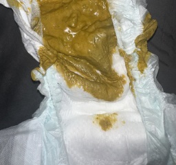 Advice please - warning nappy pictures included