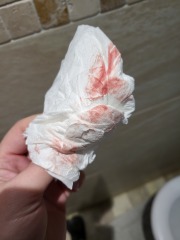 TRIGGER WARNING POTENTIAL IMPLANTATION BLEED - ADVICE NEEDED PLEASE
