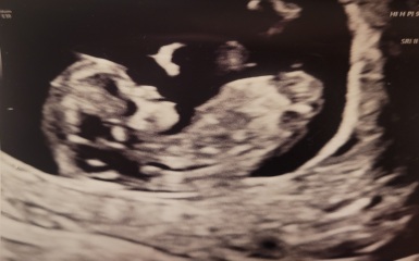Any guesses girl or boy? 💗💙