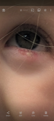 3yo stye (pic included!)