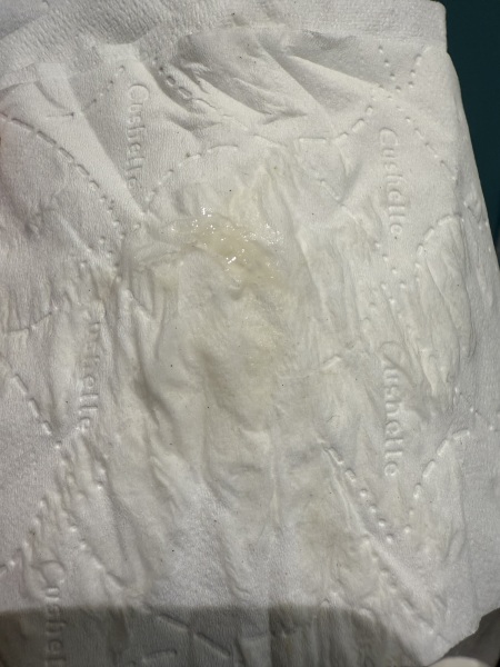 TTC after loss part 6