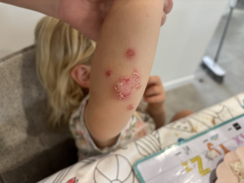 Does anyone know what these marks are?