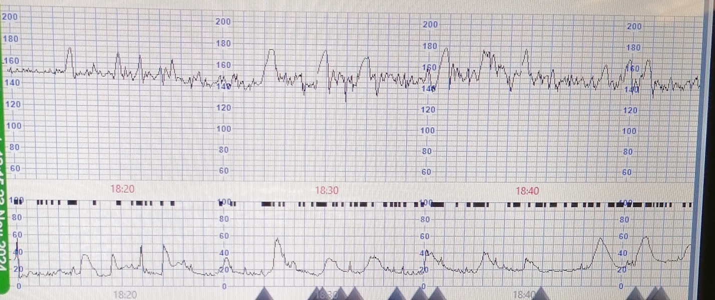 Due December 2024 - thread 2