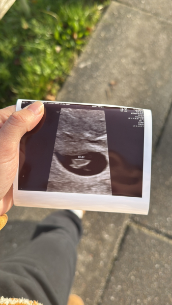 11DPO positive - but concerned