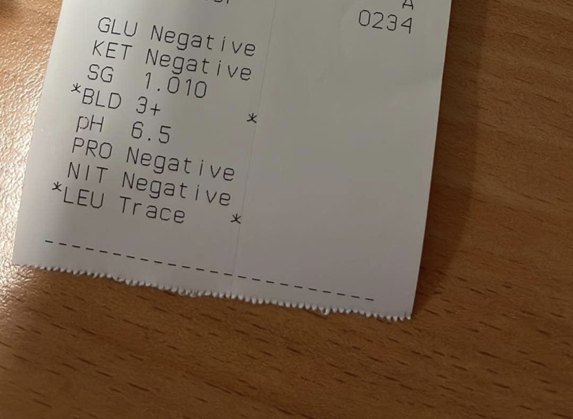 Haematuria clinic referral at 28?