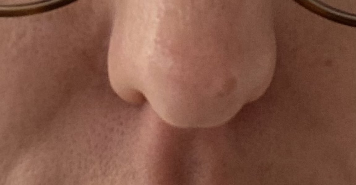 To want to chop off my unsightly nose