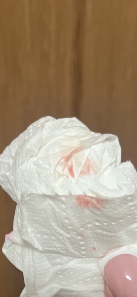 *TMI PIC* what could this bleeding be?