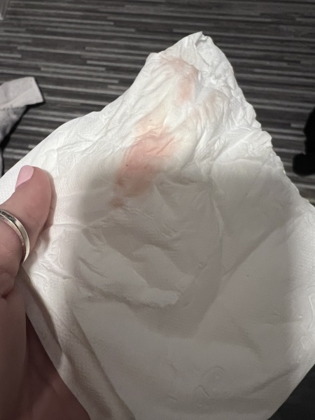 TW- Blood. Had anyone had a similar situation?