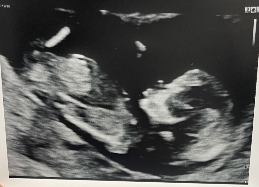 Any guesses on gender?