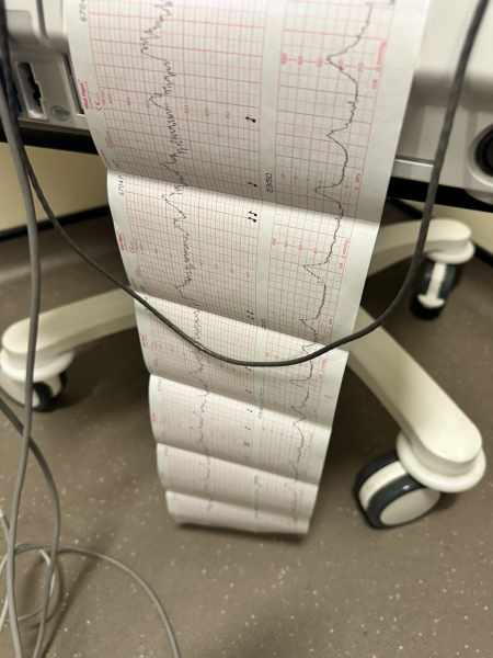 Due December 2024 - thread 2