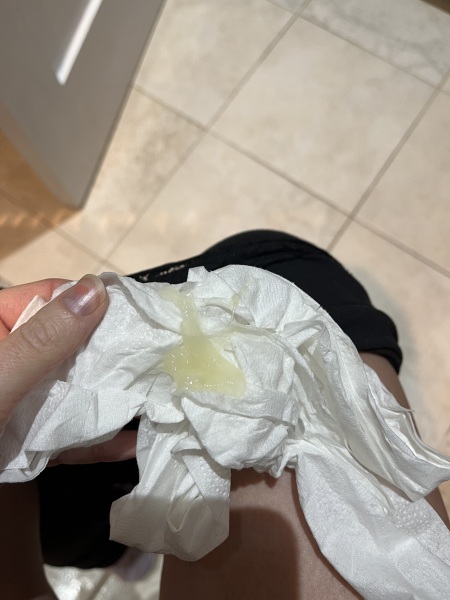 Is this my mucus plug *TMI* 26+5