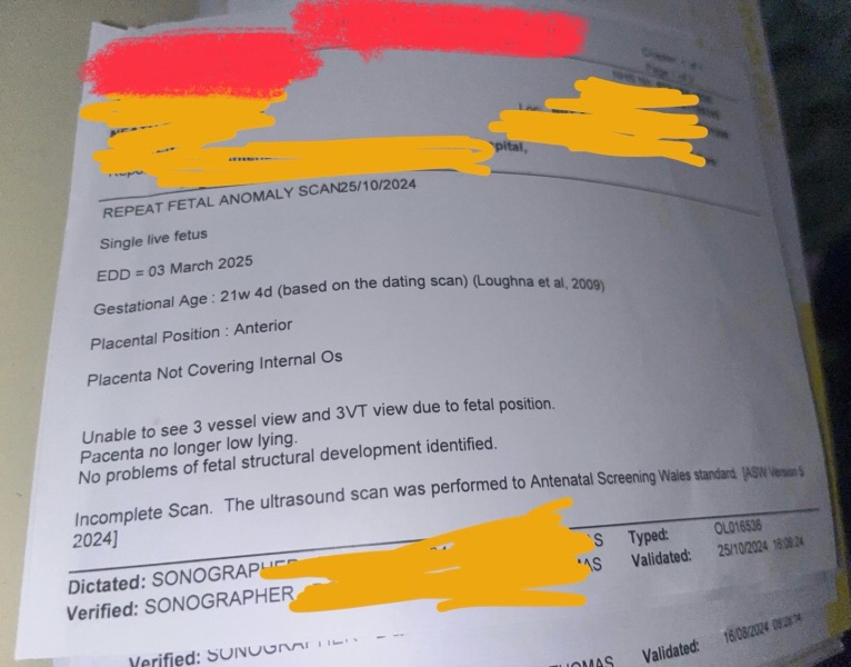 Unable to see 3 vessel view and 3VT view on scan