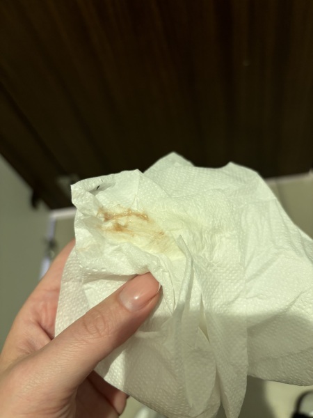 Is this discharge normal for 5w4 days