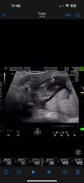 Gender Scan 15 weeks!! Please ease my mind!!