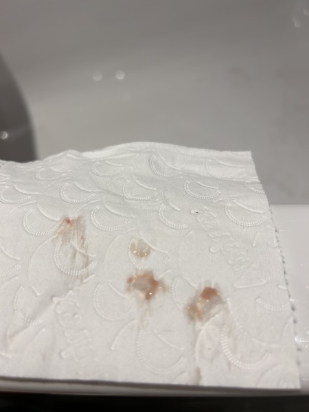 Implantation bleeding 11dpo?