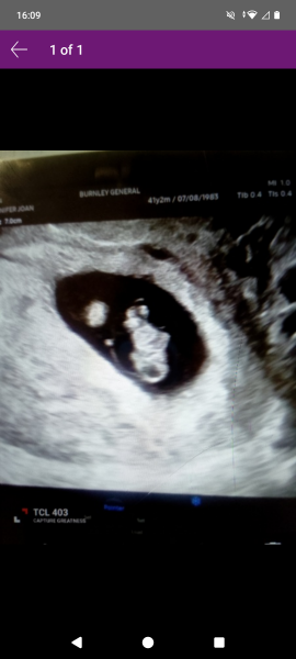 9 week scan