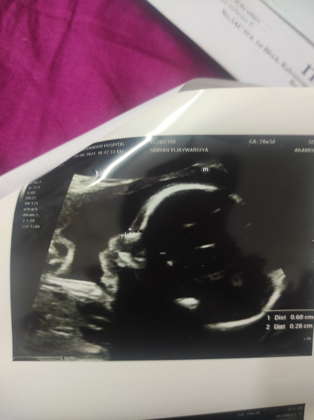 Can anyone whether it's a girl or boy with the skull theory?