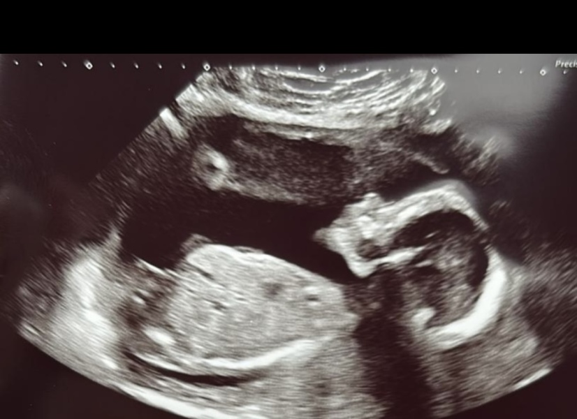 Gender guess!!