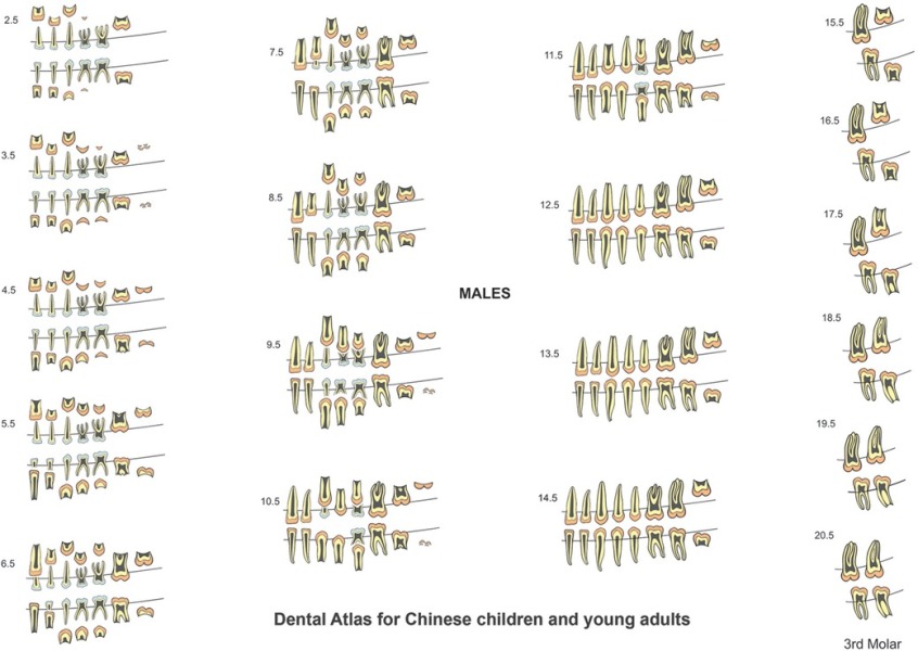 5yr old been advised to have 8 teeth out