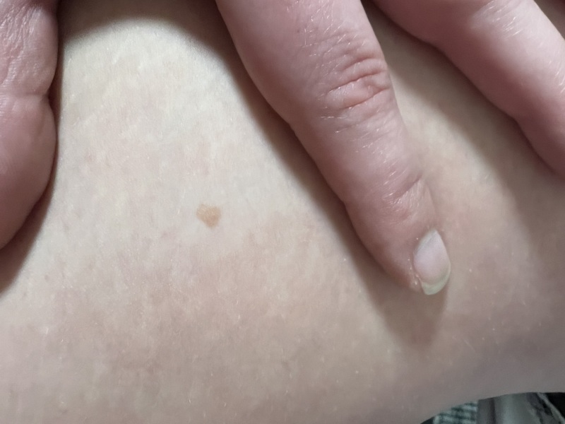 Weird mark on leg?