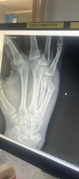Need a hand hold -Part 3