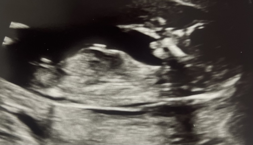 Baby number 2