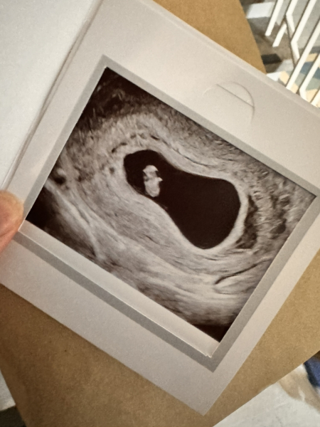 4 weeks 6 days, due 9 July 2024.. anyone wanna join?