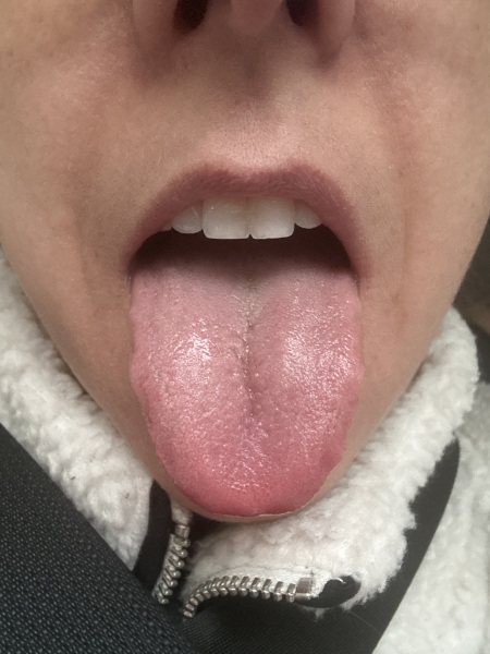 Tongue