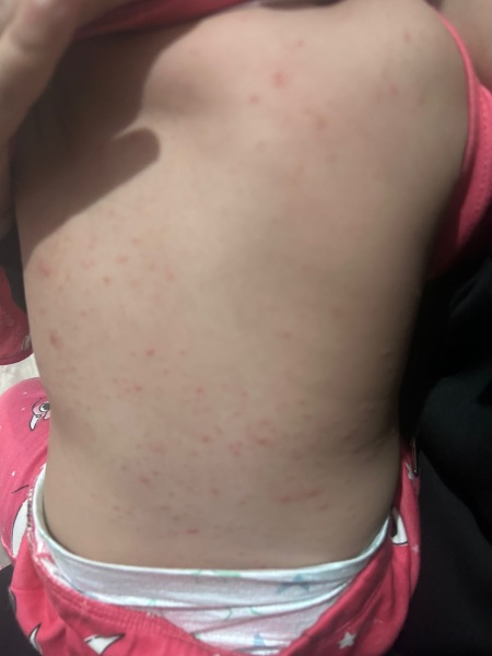 Can anyone explain what this is bcoz the doctors are pissing me off!!!