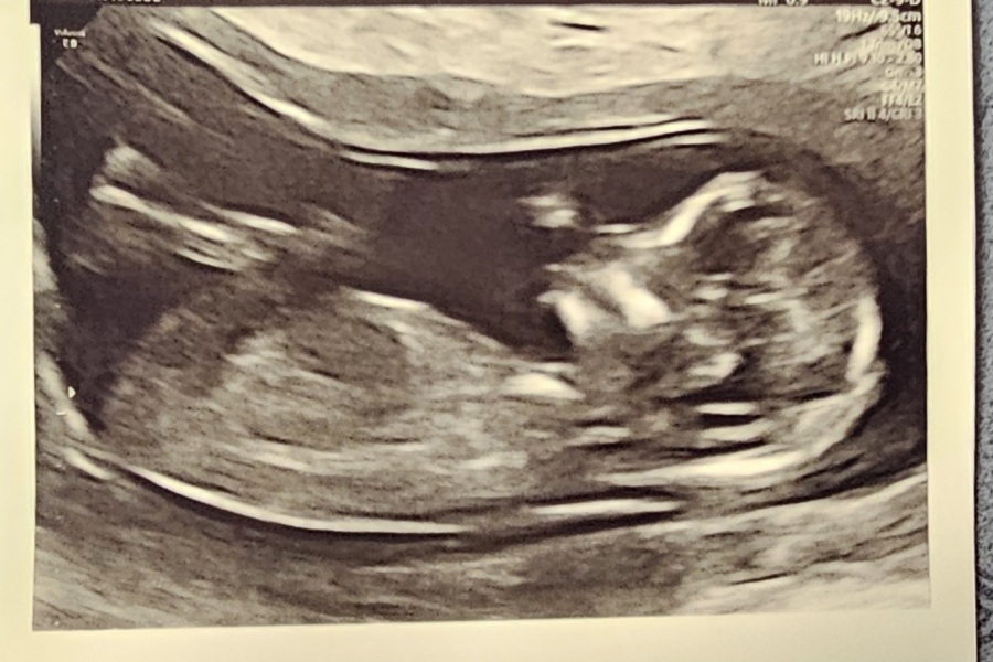 Guess the gender! 13+3