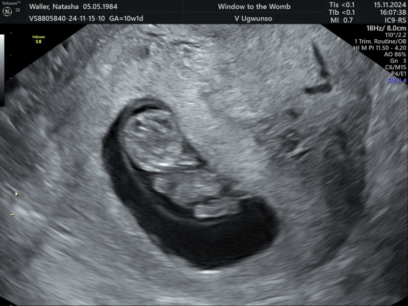Due June 2025 pt2!