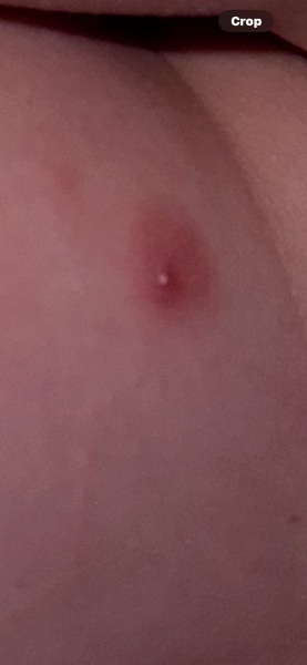 Any idea what these spots are?