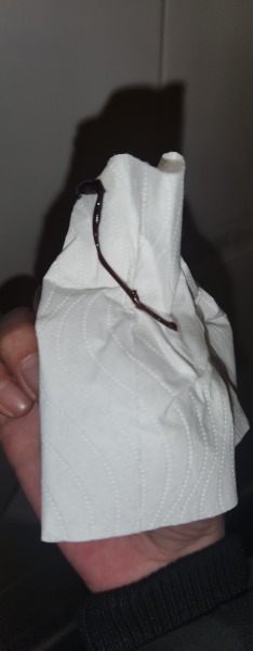 TMI warning! Spotting since CD16