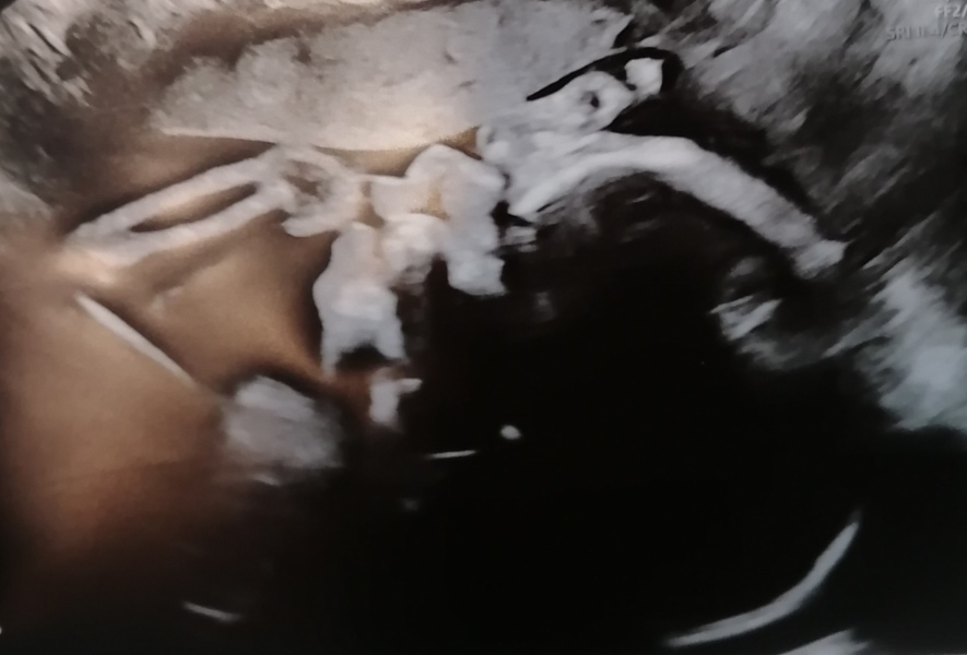 Due February 2025 - Thread 3
