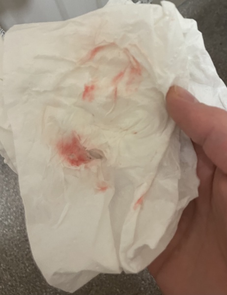 Is this implantation bleeding???