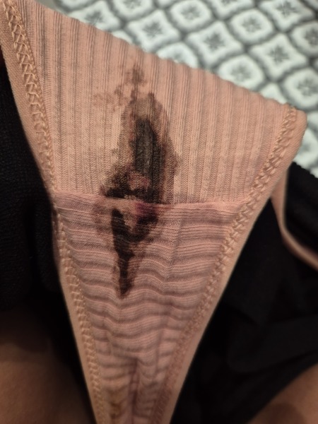 8DPO, Brown/Pink Spotting