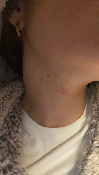 Weird cluster of spots on neck