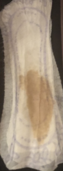 Should I Get this Checked - warning pic