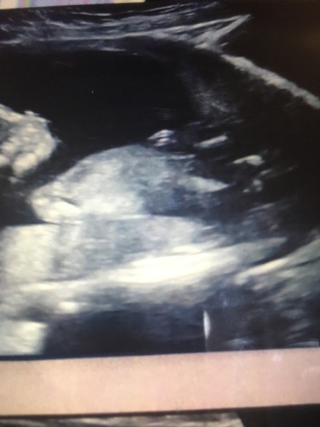 Any thoughts on gender