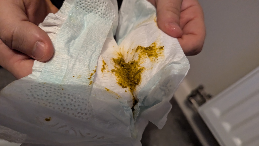 Could this be an allergy? [Content warning: contains pic of contents of nappy]