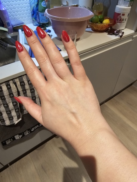 Guess the age of my hand.