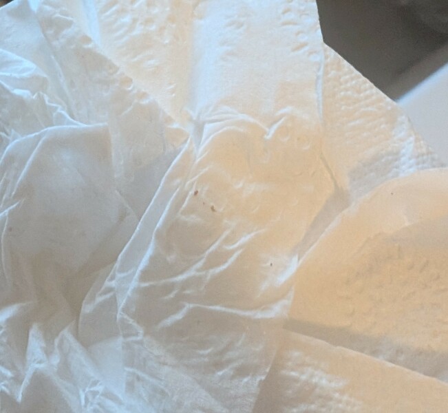 Possible Implantation?? Tmi photo!!