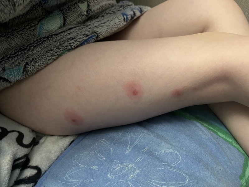 Help! Red pus spots on 5 year old