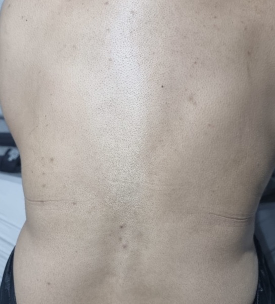 Itchy back .. help
