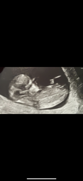 12 WEEK SCAN - NUB PREDICTIONS PLEEEEAAASE