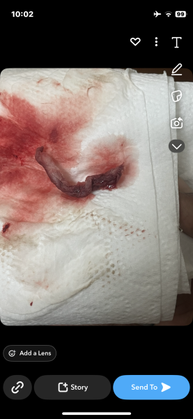 Miscarriage or regular clot