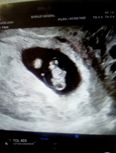 8 week scan