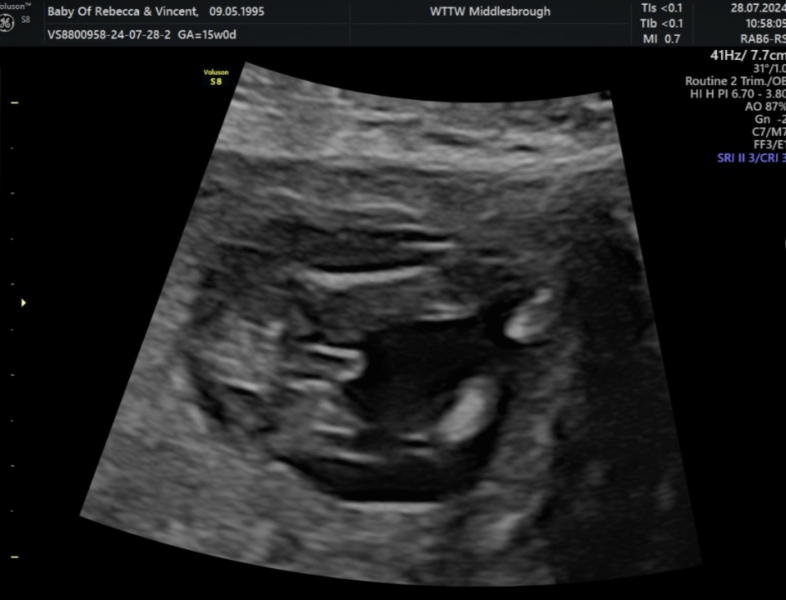 16 week scan, is this definetly a girl?!